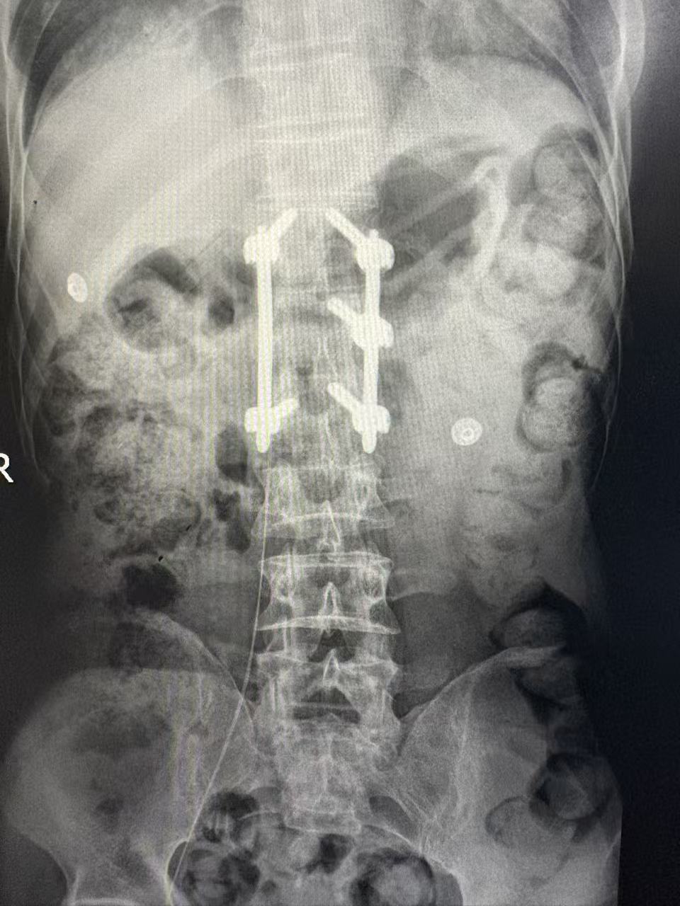 a6ece77e4c0d03acd9f3f3dfae5b087d