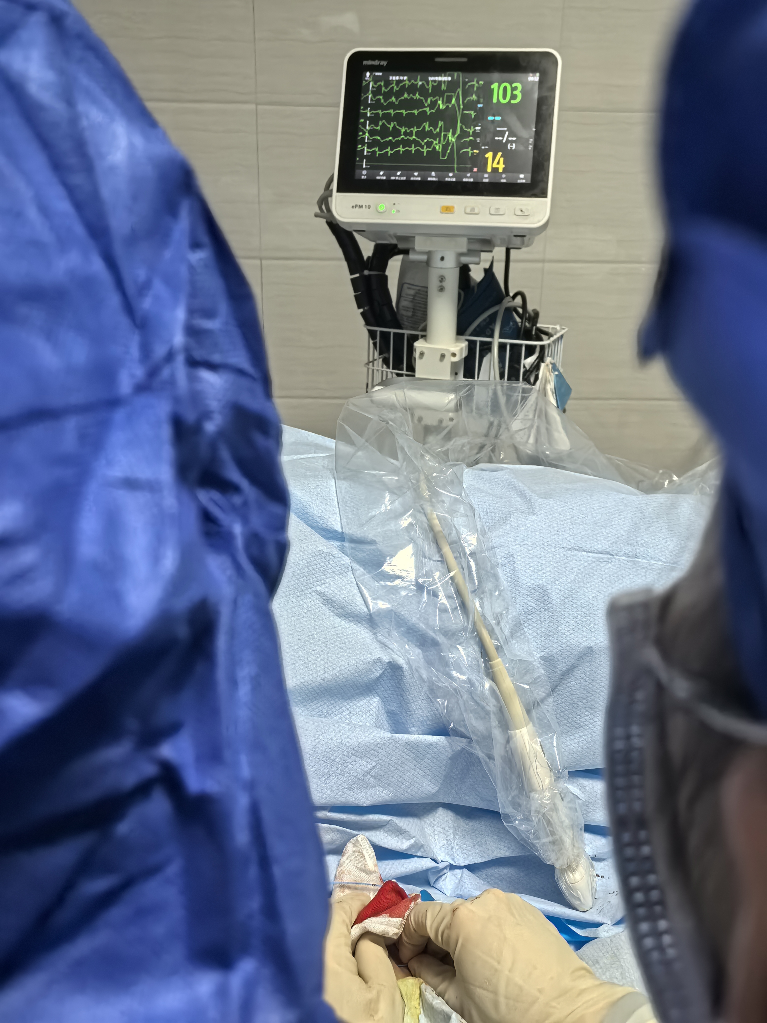 615b36b1c58cf7035efdea53ef33557d