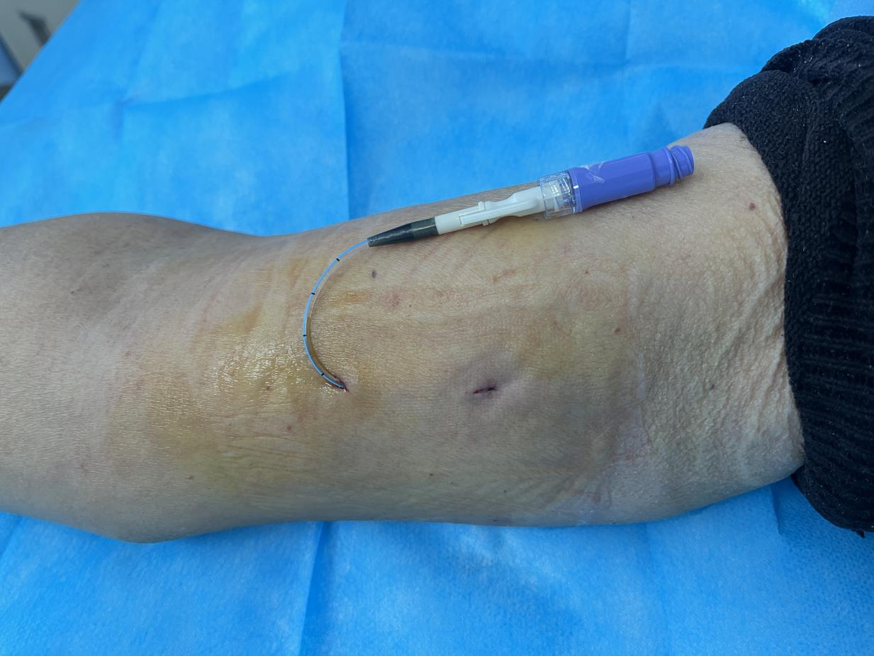 6bbdf6518e4fb20d20cf5ae6f5110487