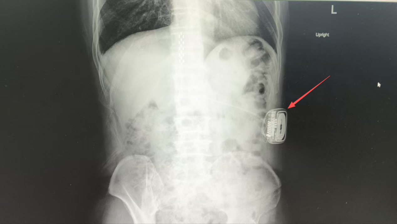 微信图片_2025-12-04_